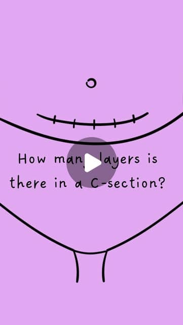 Instagram reel preview about how many layers are in a C-section